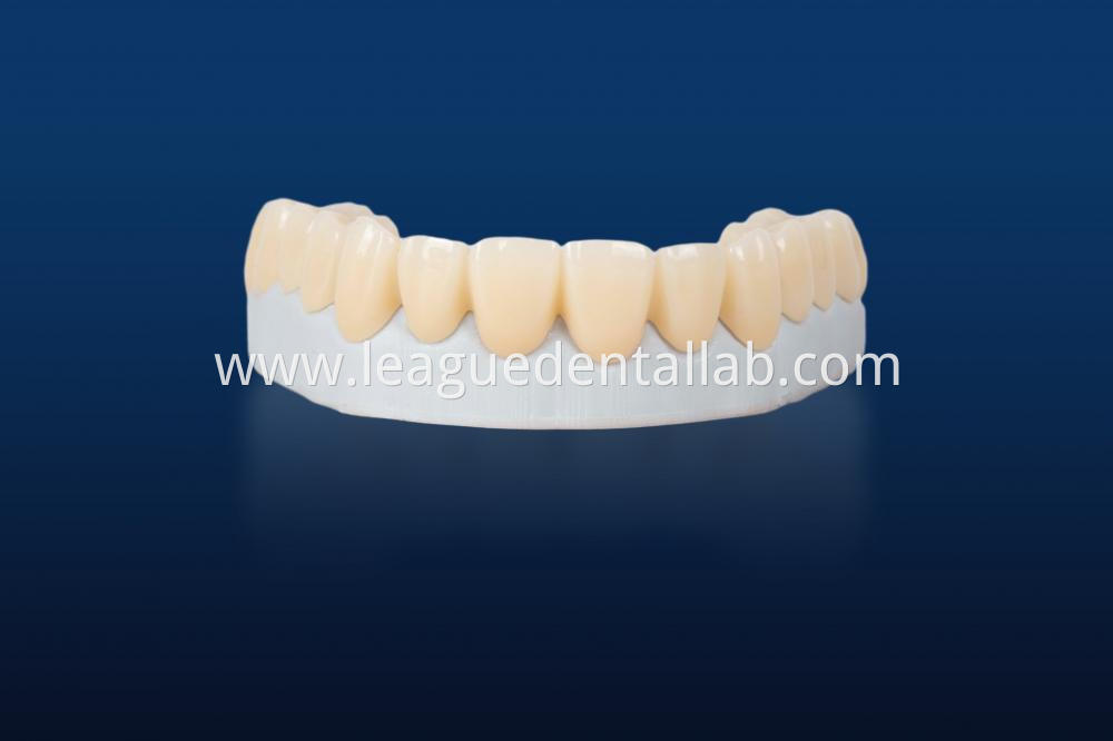 Full zirconia